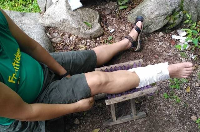 腿断掉了，多少时间内可以重新接上？——骨骼再生与恢复的奥秘