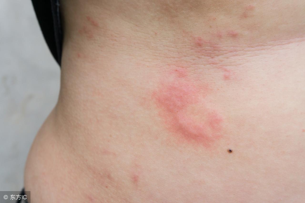被子出汗潮湿会滋生虫子吗？一篇文章带你了解真相