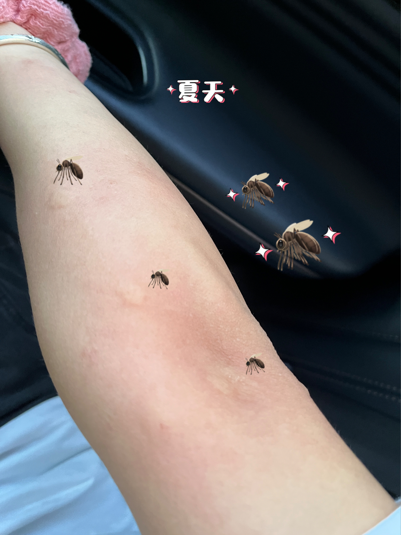 灭蚊神器真的有用吗？揭秘那些所谓的灭蚊黑科技
