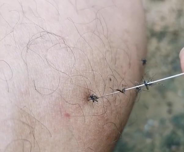 腿被烧烤签子扎伤应急处理指南