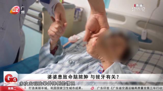 七旬老太拔牙后发生致命脑脓肿，警惕医疗风险与健康警示
