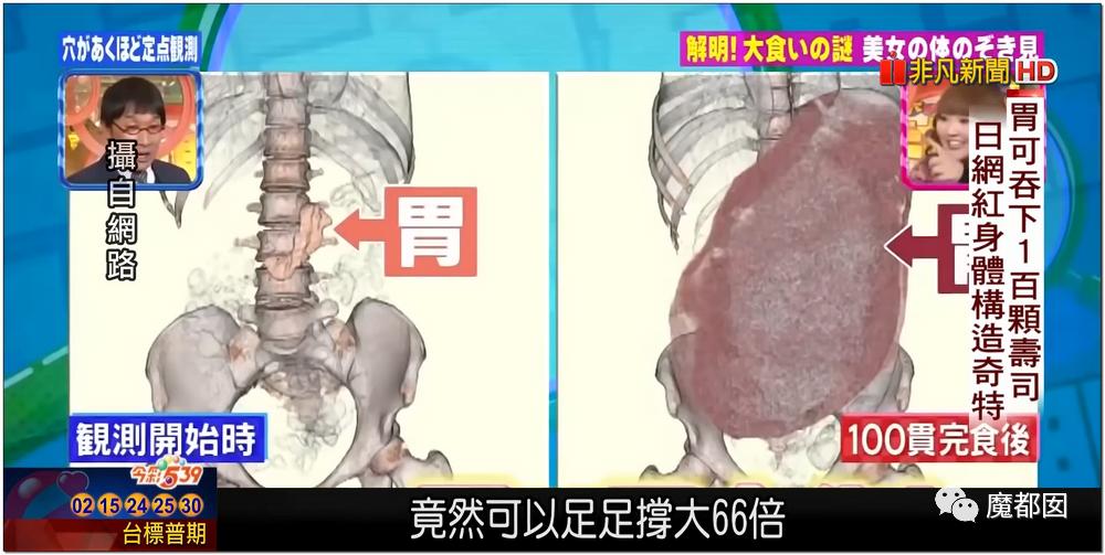 甲亢博主，分享生活，传递正能量