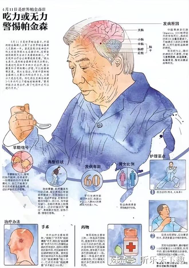 年轻人也需注意，帕金森正在年轻化