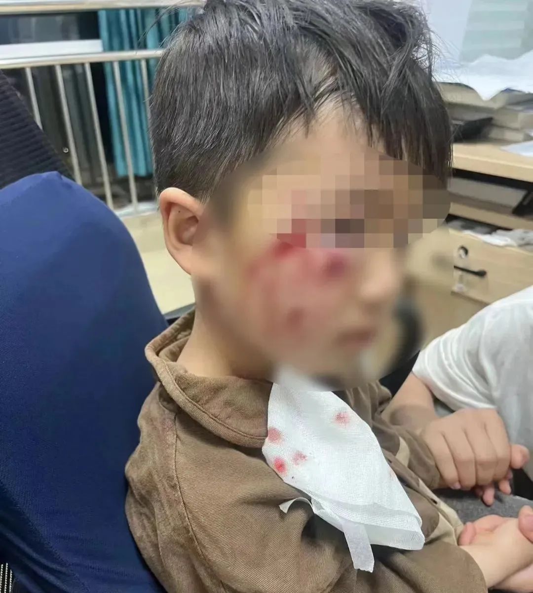 惊魂一刻，7岁男孩遭遇犬群袭击事件深度剖析