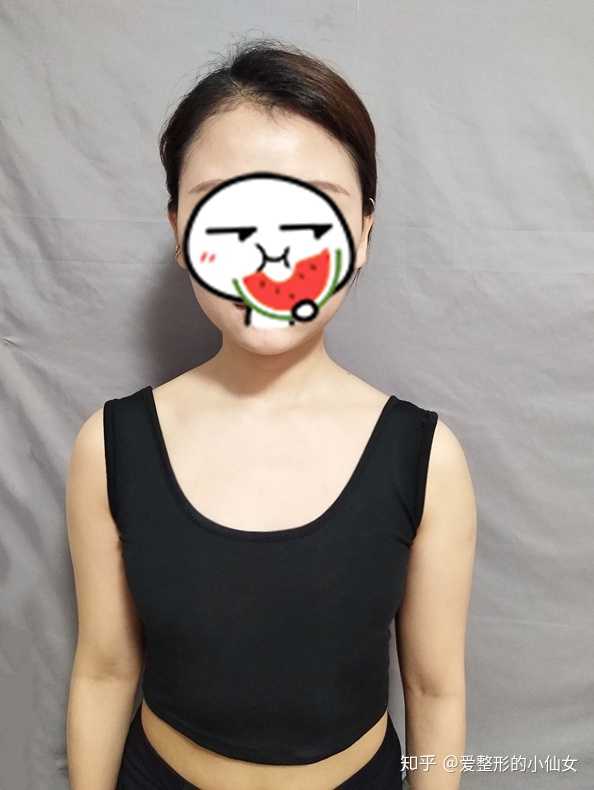 隆胸后的华丽转变，四个胸的时尚新纪元