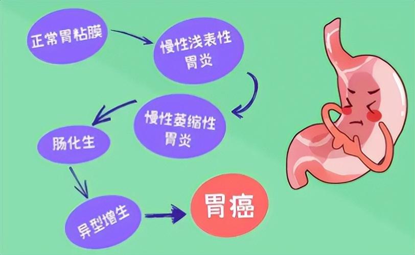 女主播3年顿顿外卖患上胃癌，警醒我们的外卖生活与健康警钟