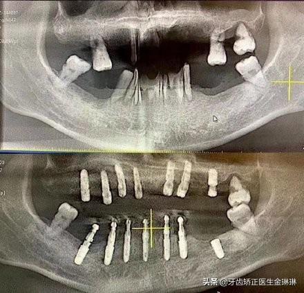 花6万种牙全卸掉，一场关于牙齿的奇幻之旅