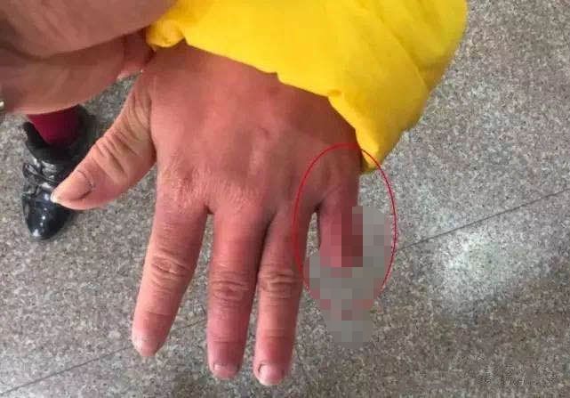 五岁女童伴父母腐尸至少五天后的求生之路，深度探究事件背后的人性之痛